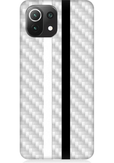 Xiaomi Mi 11 Lite Uyumlu Siyah Beyaz Metal Motif Desenli Silikon Kılıf