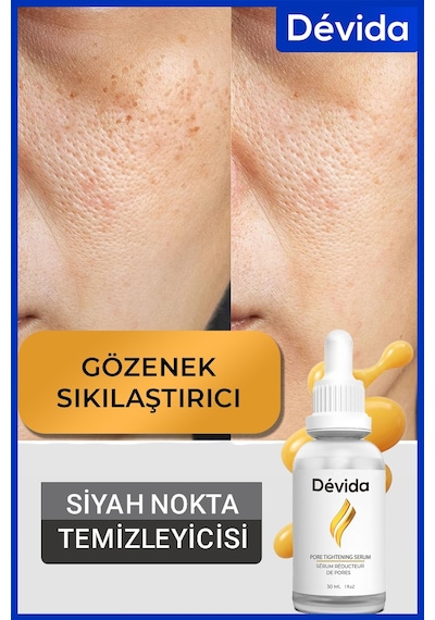 Devida Siyah Nokta Akne Gözenek Sıkılaştırıcı Vivo Series A210 30 ML
