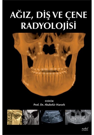 Ağız Diş Ve Çene Radyolojisi- Nobel Tıp Kitabevleri