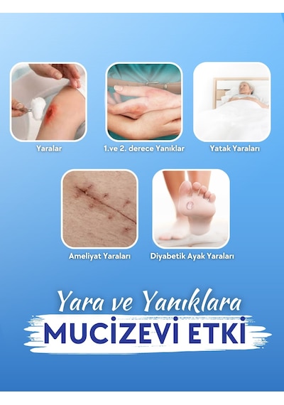 Actolind Solution Plus Yara Solüsyonu 500 ML