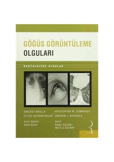 Göğüs Görüntüleme Olguları