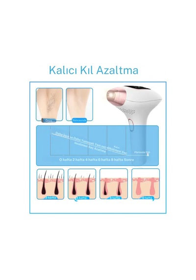 Trend Farma Soğuk Buz Ipl Lazer Epilasyon Cihazı - 999.999 Atım, Ağrısız Buz Lazer