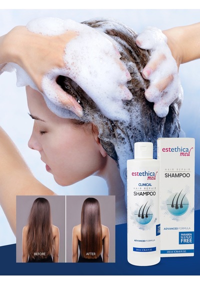 Doctor Almas Estethicamed Saç Dökülmesine Karşı Şampuan 3 x 250 ML