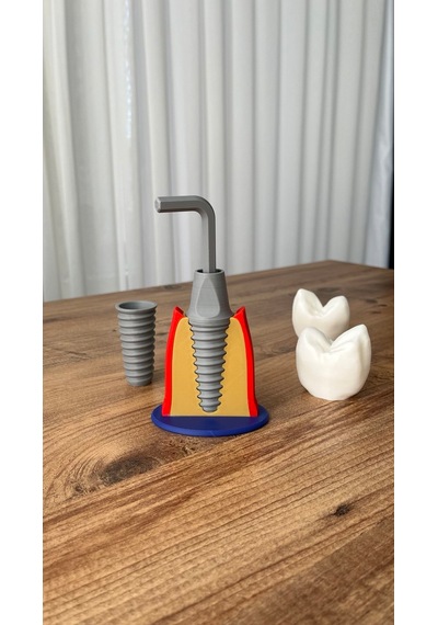 İmplant Modeli Diş Hekimliği Eğitici Model 13 CM
