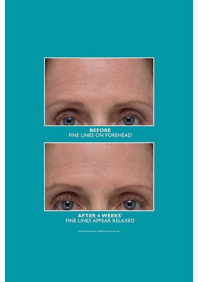 Peter Thomas Roth Peptide Skinjection Amplified Wrinkle-fix Yüz Serumu 30ml