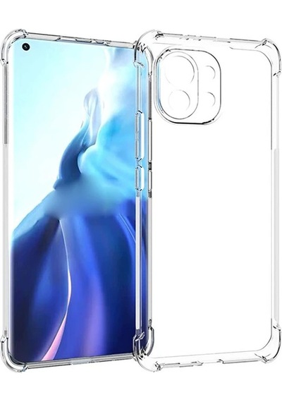 Xiaomi Mi 11 Kamera Korumalı Shockproof Darbe Emici Silikon Kılıf- 5775