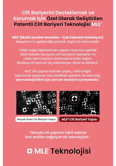 Atopik Ciltlere Özel Cilt Bariyerini Destekleyen Yoğun Nemlendirici Krem Atopalm Mle Cream 100 Ml