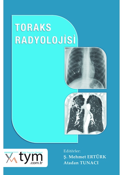 Toraks Radyolojisi