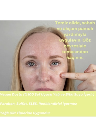 Skin Care Toner - Yağlı Ciltler İçin Cilt Bakım Suyu
