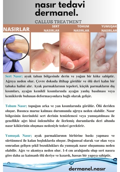 Dermanel Ayak Bakım Spreyi 100 ML + Dermanel Nasır Seti 45 ML