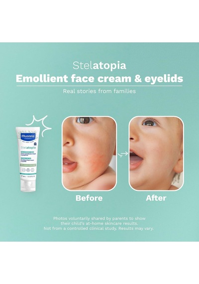 Stelatopia Emollient Yüz Kremi 40 Ml