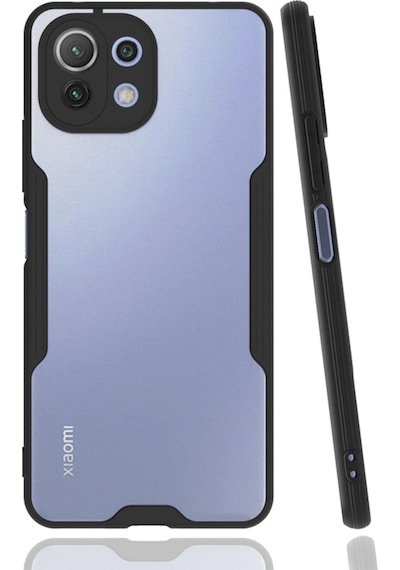 Xiaomi Mi 11 Lite Kılıf Platin Silikon - Siyah -
