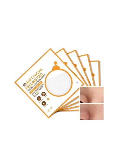 Mjcare Face Peeling Pad 5'li