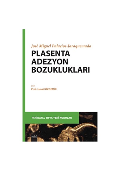 Plasenta Adezyon Bozuklukları N11.1514