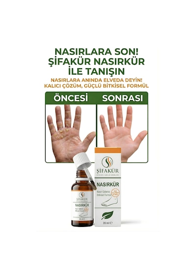 Nasırkür Bitkisel Nasır Sökücü Solüsyon 20ml Törpü Ve 8'li Koruyucu Ped - Tam Bakım Seti