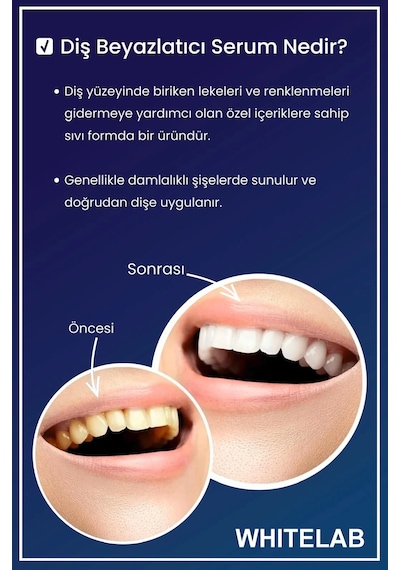 Whitelab Diş Beyazlatıcı