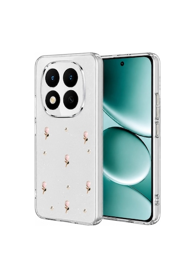Xiaomi Redmi Note 15 4g Fiyonk Desenli Kapak - Desen 6