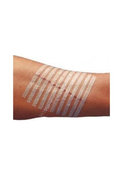 3M Steri Strip Yara Dikiş Bandı