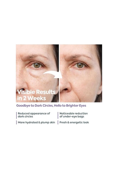 Clasy Care Göz Altı Kremi Morluk Ve Şişlik Karşıtı %5 Kafein +%2 Hyalüronik Asit Kırışıklık, Torba Ve İnce Çizgiler İçin Aydınlatıcı Göz Kremi Kore Esintili Göz Çevresi Kremi, 40 Ml