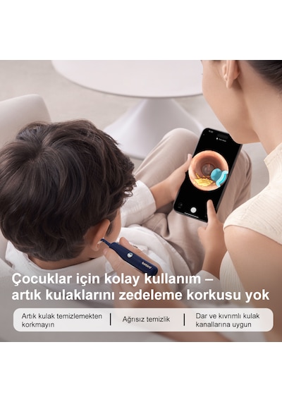 Bebird Earsight Plus Hd Kameralı Akıllı Görsel Kulak Temizleme Cihazı- Mavi
