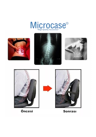 Microcase Ortopedik Sırt Bel Minderi Fileli Destekli Ayarlanabilir Araba Koltuk Sandalye 1 Adet Al5380 Siyah