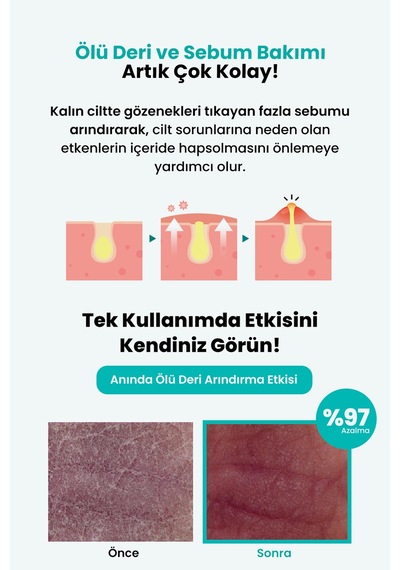 Akneye Eğilimli Ciltlere Leke Karşıtı Aydınlatıcı Vücut Losyonu Derma:b Ac Control Body Lotion