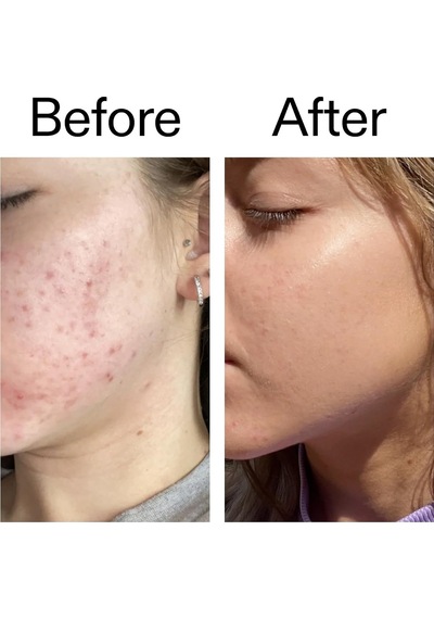 10% Niacinamide Serum 30ml