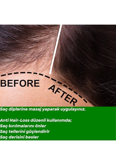 Antı Haır Loss- 10 Forces Saç Dökülmelerine Karşı 10 Aromatik Yağ Karışımı