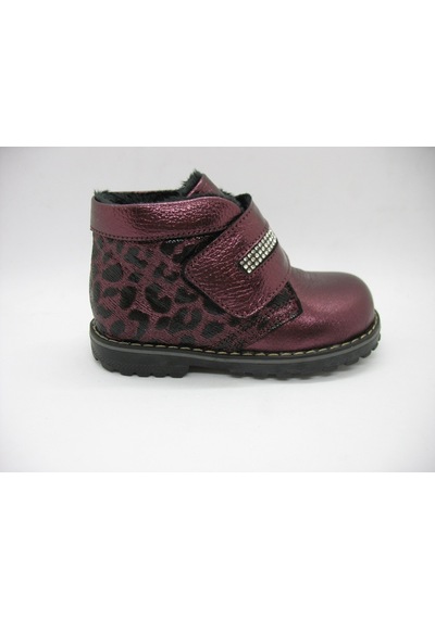 Toddler 02205 Deri Ortopedik Destekli Bot 21-25 (450170921) Bordo