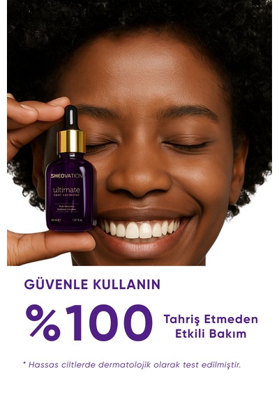 Sheovation Leke Serumu 30 ML