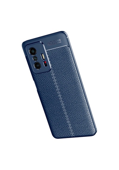 Xiaomi Mi 11T 5G Kılıf Zore Niss Deri Desenli Silikon Kılıf
