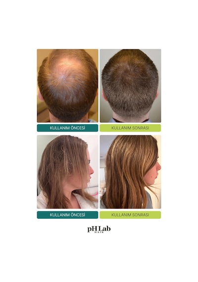 Phlab Hair Exosome Nad+ & Triple Pdrn Scalp Shot