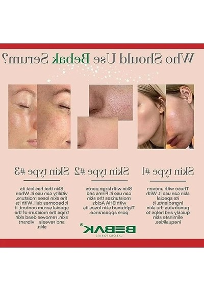 Kırmızı Peeling Serum - 30 Ml