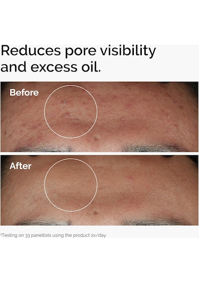 The Ordinary Niacinakarın Bölgesi 10% + Zink 1% 30ml