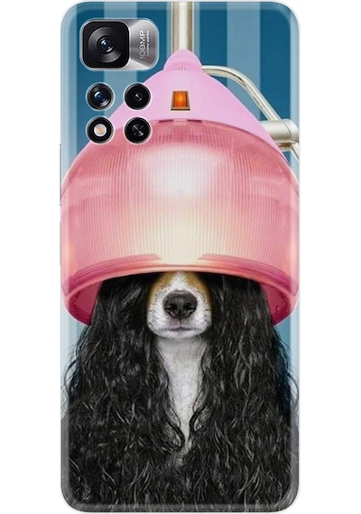Xiaomi Redmi Note 11 Pro Kılıf Resimli Desenli Baskılı Silikon Earring Woman 1363