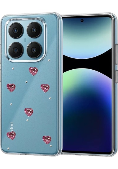 Newface Xiaomi Redmi Note 14 Pro 4g Fiyonk Desenli Kapak - Desen 3 Mavi