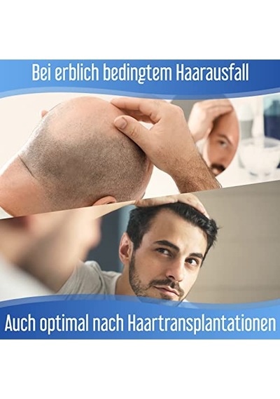 Depnipharma Hair Forte Erkek Saç Dökülmesi Engelleyici Sprey 60 Ml