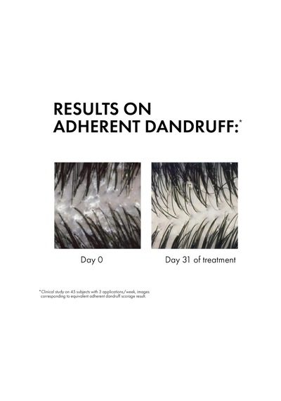 Vichy Dercos Anti-dandruff Kepek Karşıtı Bakım Şampuanı - Kuru Saçlar 390 Ml Diğer