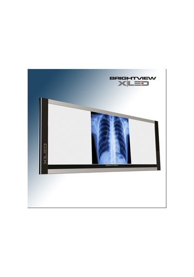 İnce Üçlü Negatoskop X Ray Film Viewer