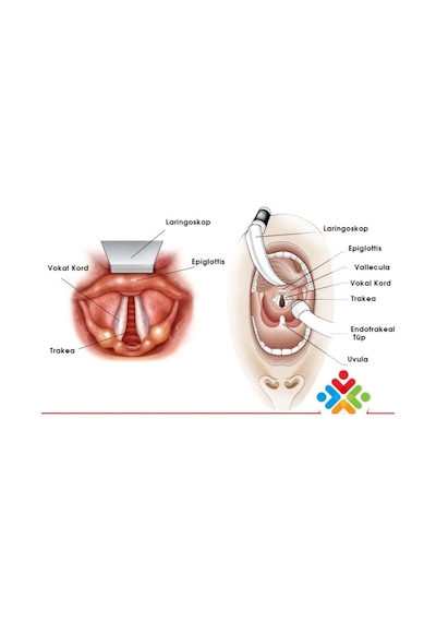 Entübasyon Tüpü Kaflı Endotrakeal Tüp Balonlu 1 Adet No:7.5