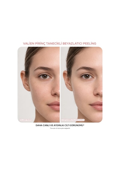 Vàlıen Pirinç Tanecikli Yüz Peelingi Beyazlatıcı 150 Ml