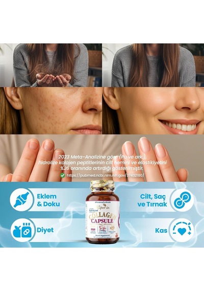 Collagen Kapsül 30 Adet, Hidrolize Peptit 500 Mg, Tip 1-3-5-10, C Vitamini, Çinko, D3, Biotin, Selenyum, Hyaluronik Asit Ve Yumurta Zarı