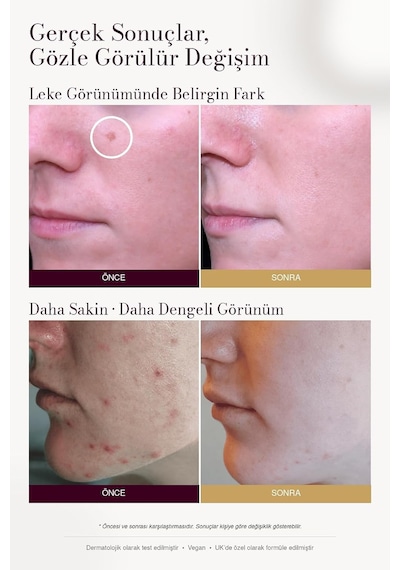 Leke Karşıtı Ve Aydınlatıcı C Vitamini Serum 30ml Arbutin, Tranexamic Asit, Niacinamide, Hyalüronik Asit - Gözenek Sıkılaştırıcı Etki