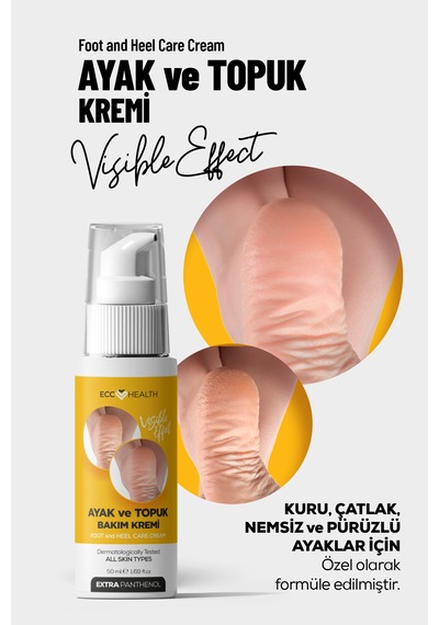 Ayak Ve Topuk Çatlak Bakım Kremi 100 Ml Kuru, Sertleşmiş Ve Pürüzlü Ayaklar İçin
