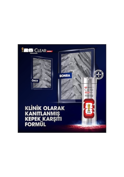 Men Kepeğe Karşı Etkili Şampuan Scalp Edition Fifa World Cup 330 Ml X3
