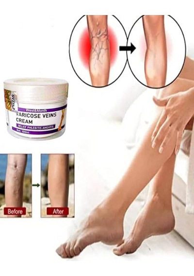 West & Month Varicose Vein Var.is Karşıtı Bakım 100 Ml
