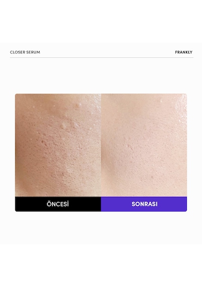 Closer Serum 9 Peptit İçeren Gözenek Sıkılaştırıcı Ve Yaşlanma Karşıtı 30 Ml