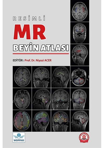 Resimli Mr Beyin Atlası