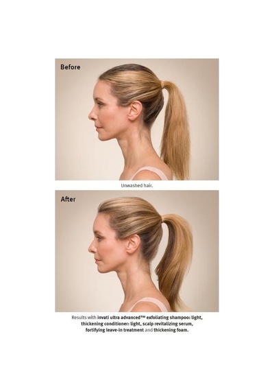 Aveda Invati Ultra Advanced Dökülme Karşıtı Saç Serumu 30 Ml