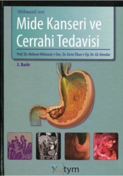 Mihmanlı'Nın Mide Kanseri Ve Cerrahi Tedavisi